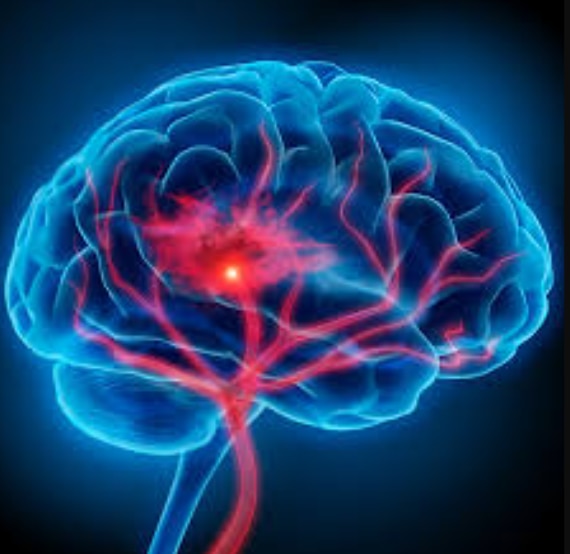 Neurology and Neuros